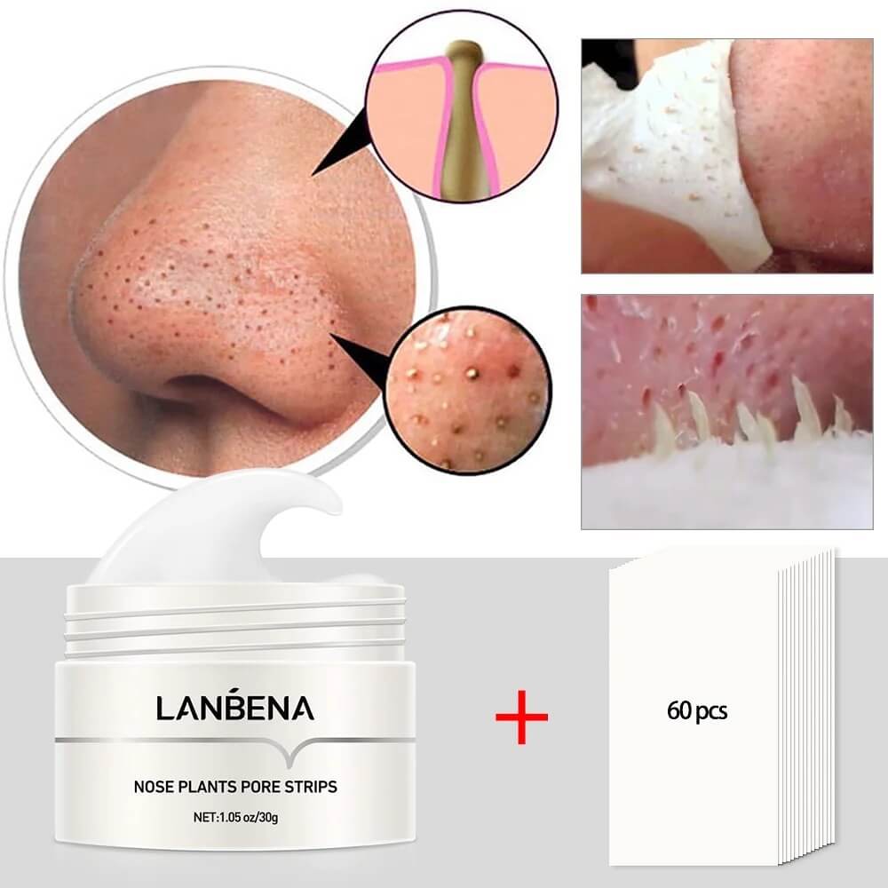 LANBENA - Gesichtsmaske gegen Mitesser