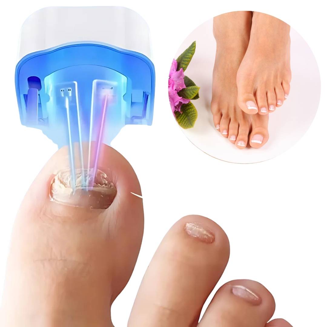 ClearNagel Pro | Nagelpilz-Lasergerät - Schmerzfrei - Effektiv