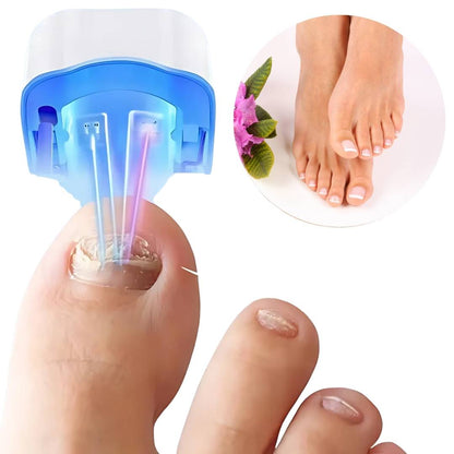 ClearNagel Pro | Nagelpilz-Lasergerät - Schmerzfrei - Effektiv