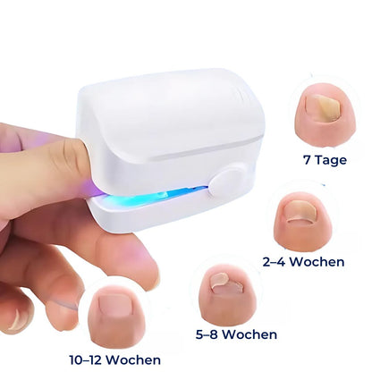 ClearNagel Pro | Nagelpilz-Lasergerät - Schmerzfrei - Effektiv