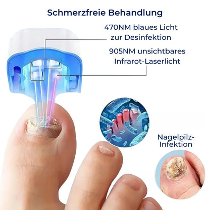 ClearNagel Pro | Nagelpilz-Lasergerät - Schmerzfrei - Effektiv